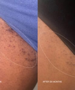 Alternative view of Ingrown Duo