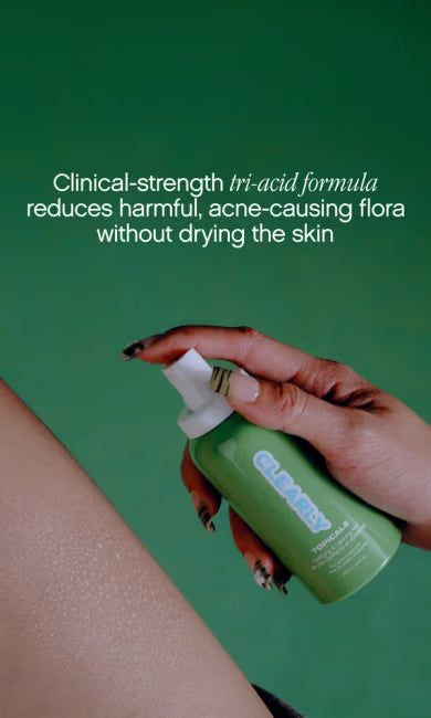 Acne Double Team - Image 23