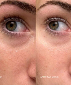 Alternative view of Faded Under Eye Masks