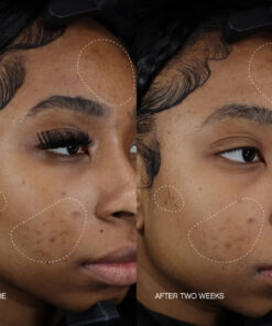 Alternative view of Faded Serum (Original Formula)