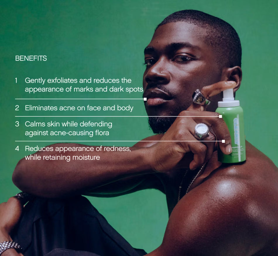 Acne Double Team - Image 18